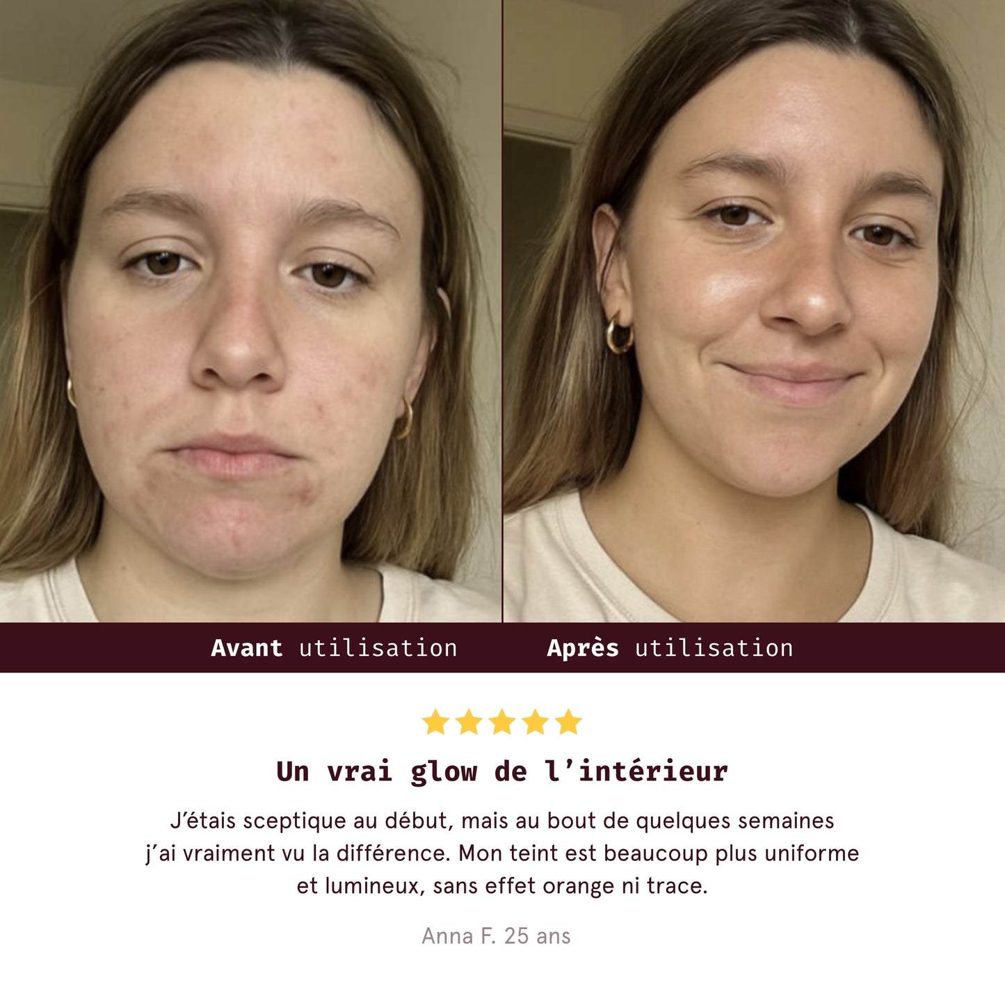 Autobronzant comestible